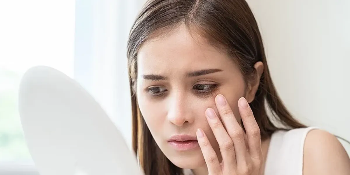 Mungesa e vitaminave dhe rrathët e errët nën sy